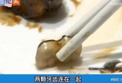 媒体爆料假牙视频,媒体曝光惊人视频曝光全过程